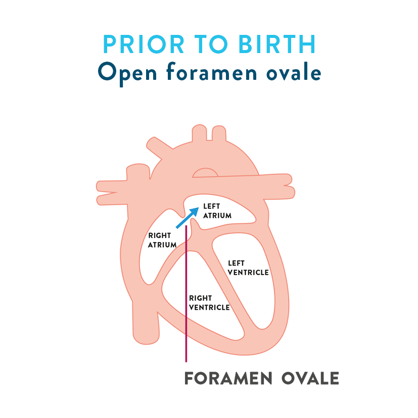 Prior to birth foramen ovale