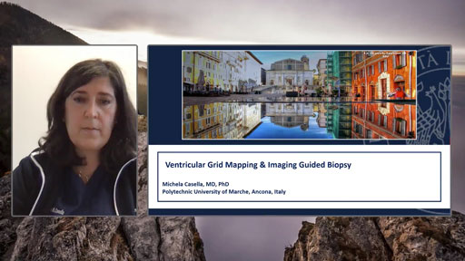 Prof Casella shares a case report of Biopsy guided by HD Grid Mapping and Advanced Imaging Techniques