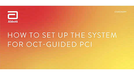How to set up the system for OCT-guided PCI