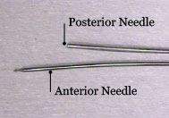 No suture or link present 
