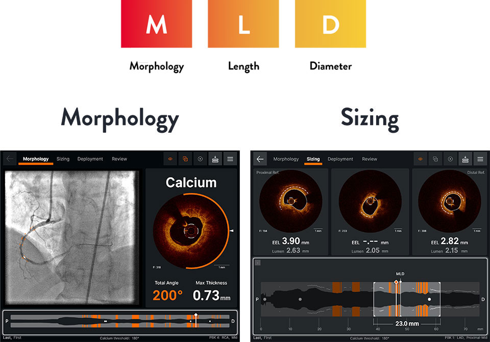 Ultreon™ 1.0 Software intuitive workflow interface - MLD
