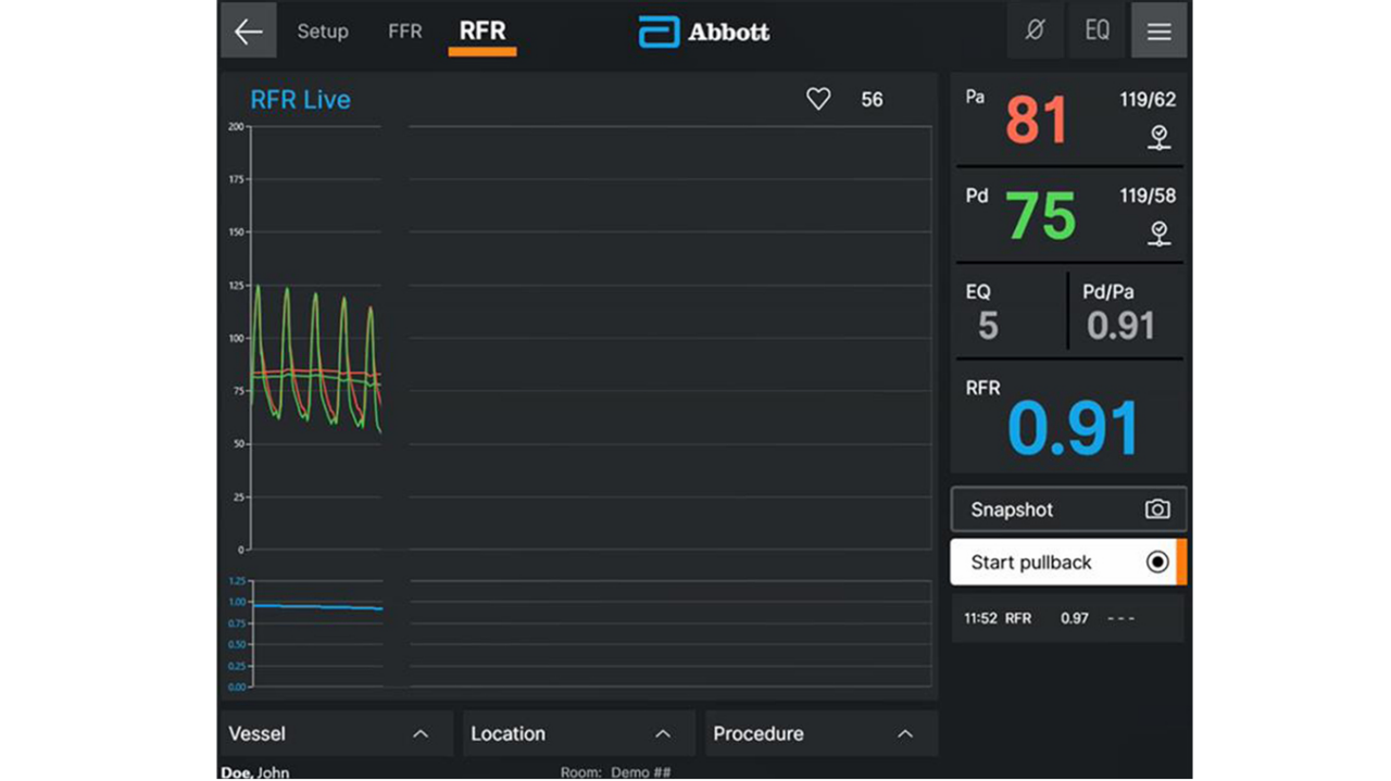 Ultreon Software 2.0 for both OCT and Physiology