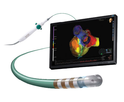 TactiCath Contact Force Ablation Catheter and Monitor Showing Cardiac Mapping