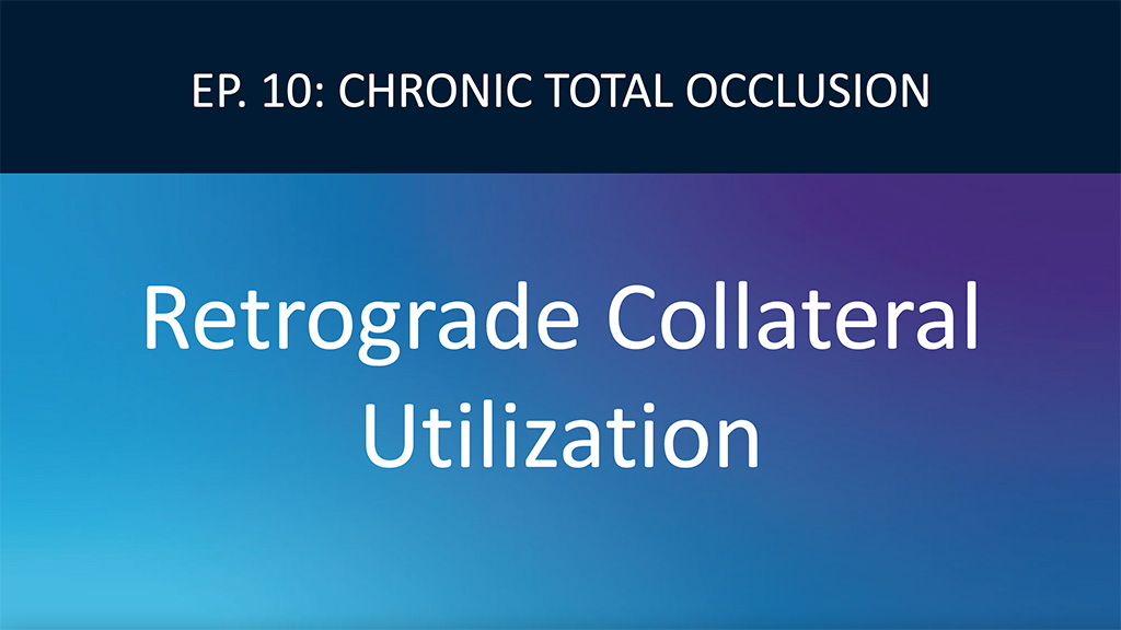 Retrograde Approach and Evaluating Collaterals in CTO PCI Video