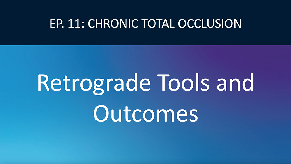Equipment and Outcomes in a Retrograde PCI Approach Video