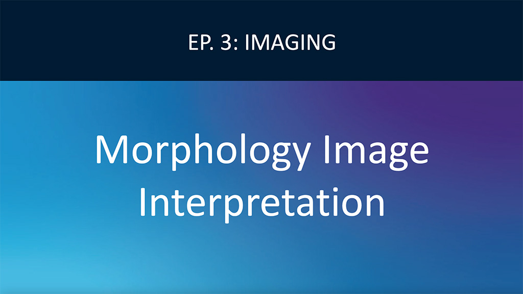 Characteristics of various morphologies on OCT/IVUS Video