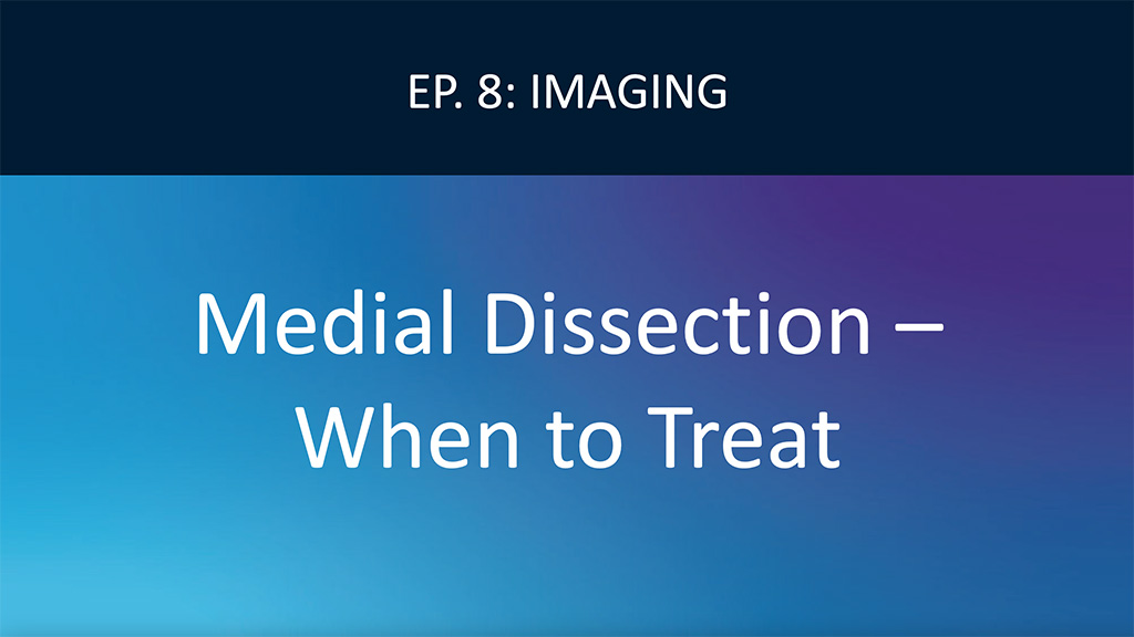 When to Treat Medial Dissection Video