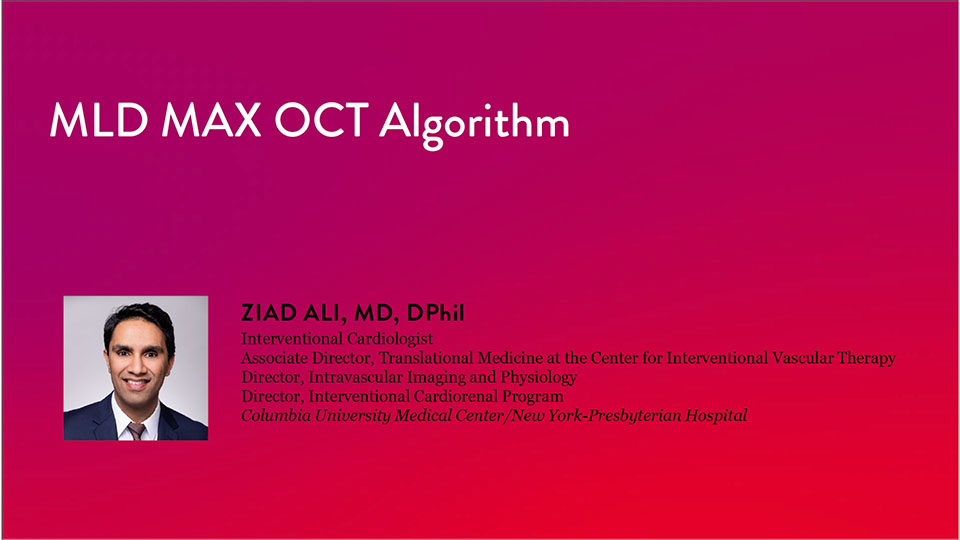 MLD MAX OCT Algorithm and how to optimize PCI Video