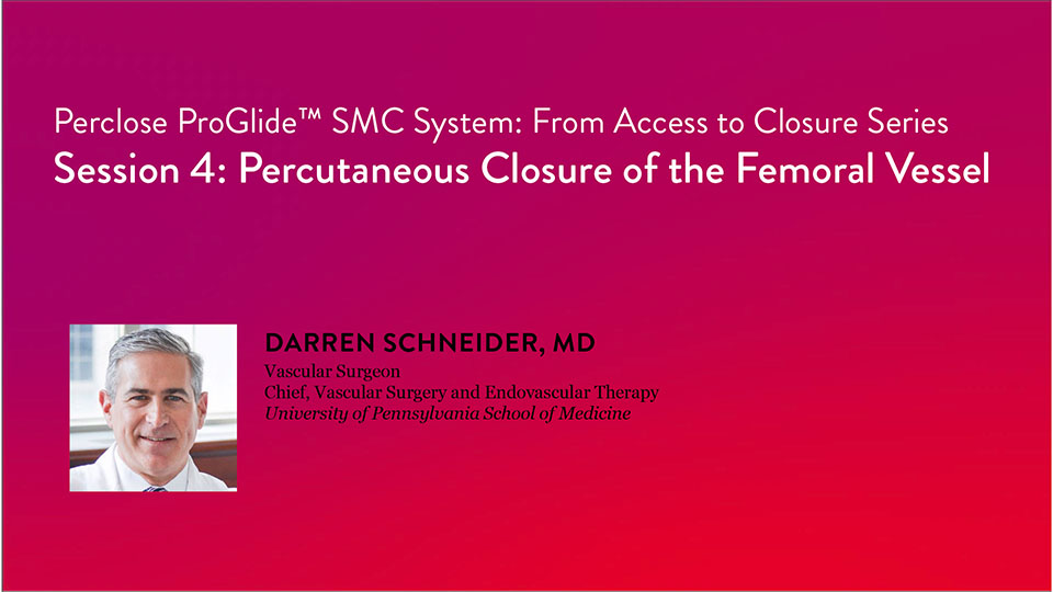Perclose ProGlide SMC System Percutaneous Closure of Femoral Artery Video