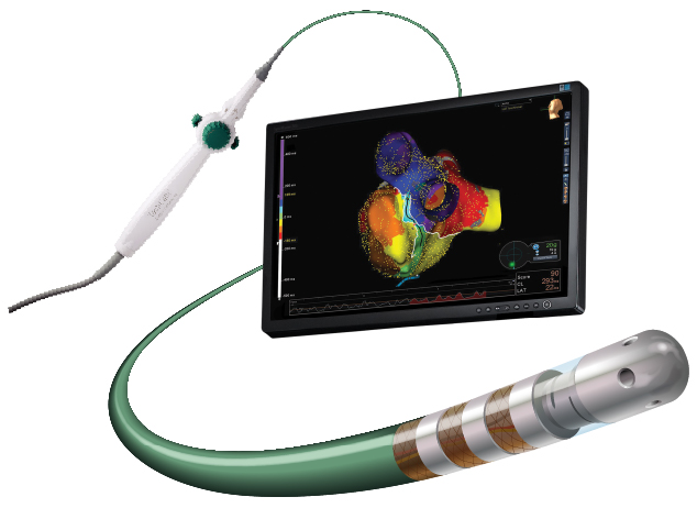 TactiCath Contact Force Ablation Catheter, Sensor Enabled