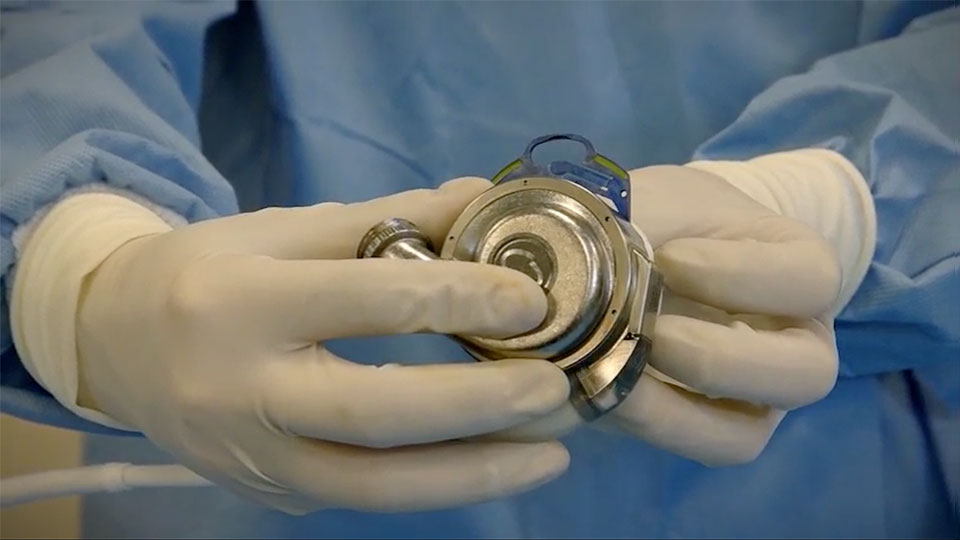 Connecting the Pump to the Apical Cuff Video