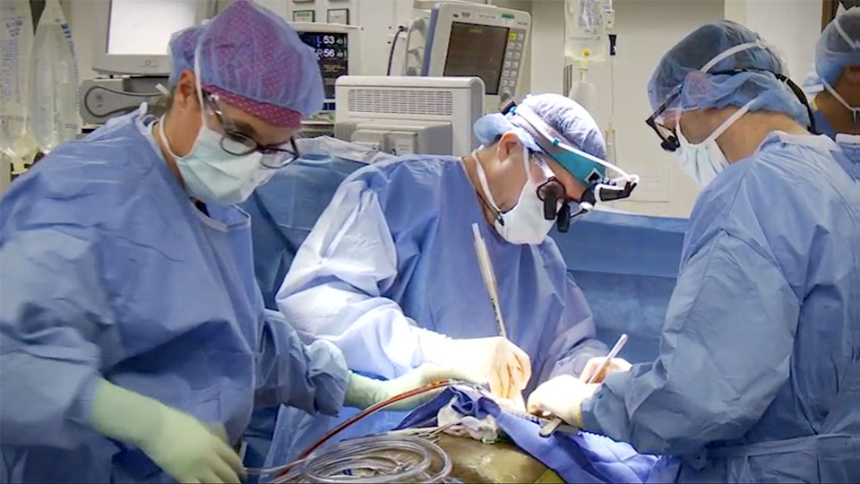 Preparing the Left Ventricular Inflow Cannula Site Video
