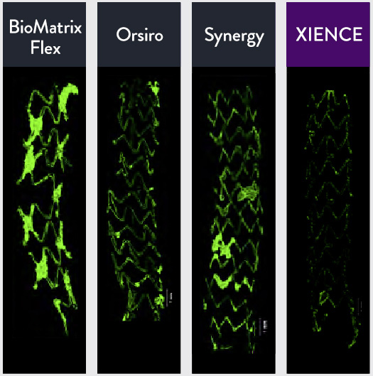 XIENCE™ Stent has far fewer platelets adhering, making it more thromboresistant vs BioMatrix Flex, Orsiro and Synergy.