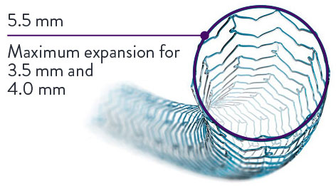 XIENCE Stent post-dilation capability is 5.5 mm.