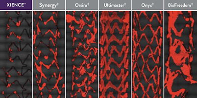 XIENCE Stent shows significantly less platelet adhesion vs other stents: Synergy, Orsiro, Ultimaster, Resolute Onyx, Biofreedom.