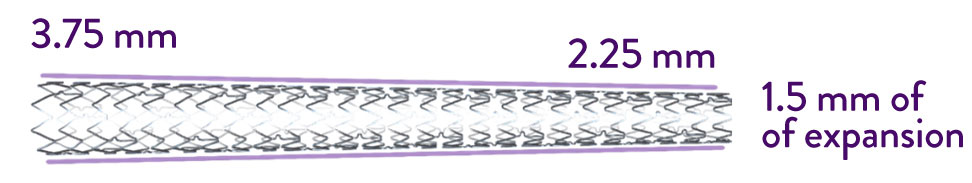 XIENCE Skypoint Stent diameter sizes 2.25 to 3.25 mm can treat small tapered vessels with an expansion diameter up to 3.75 mm. 