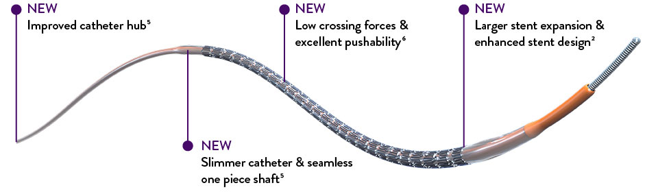 XIENCE Skypoint Stent has new features to aid in deliverability and pushability. 