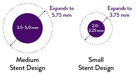 XIENCE Stent expands up to 5.75 mm for 3.5-mm to 4.0-mm stents, and smaller sizes expand from 2.0 mm up to 3.75 mm.