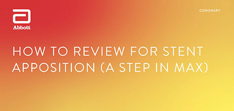 How to Review for Stent Apposition