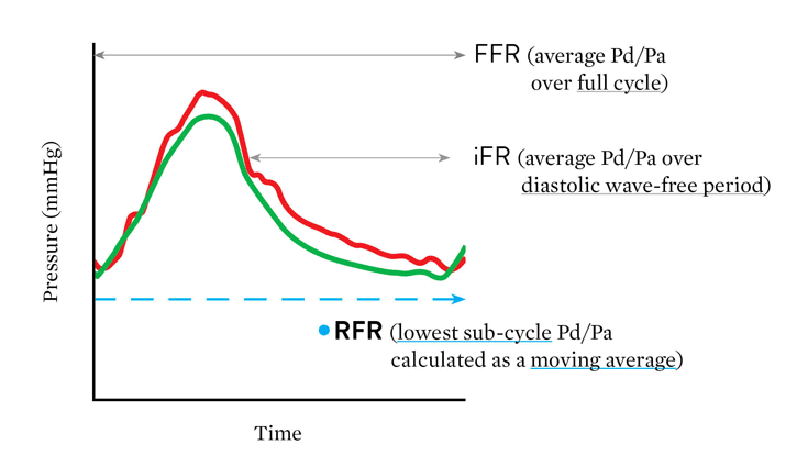 Resting full-cycle ratio (RFR) finds the lowest value of Pd/Pa, whether in diastole or systole