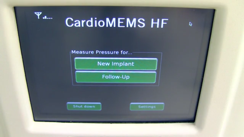 Live CardioMEMS PA Sensor Implant
