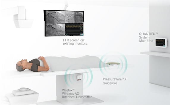 QUANTIEN’s interaction with the PressureWire guidewire and wireless interface
