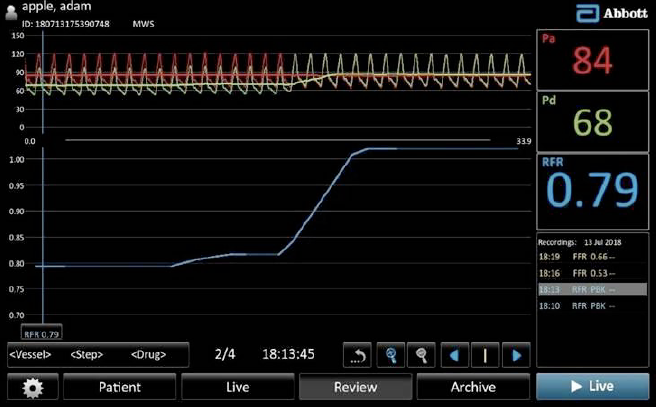 Touchscreen showing resting full-cycle ratio (RFR) hemodynamic assessment