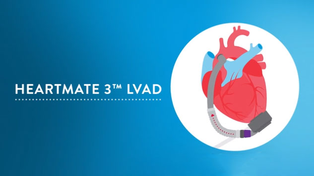 How HeartMate 3 LVAD Works