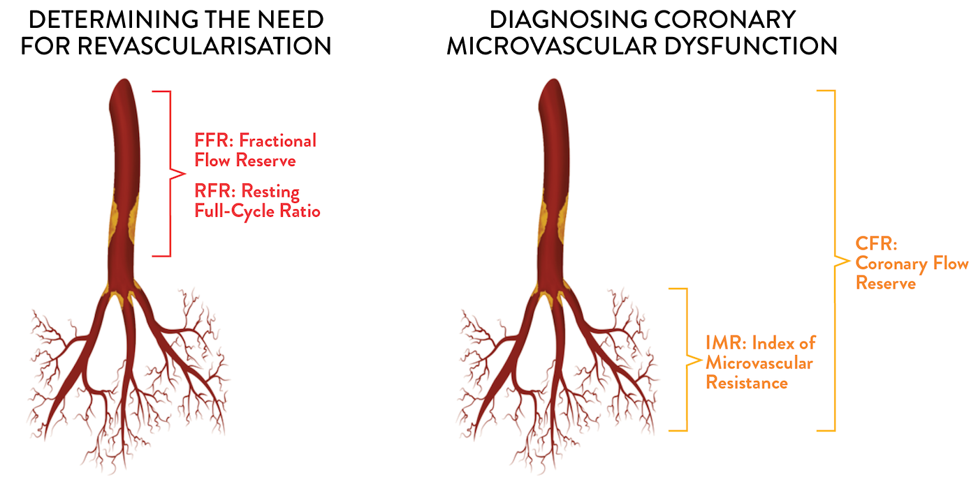 FFR and RFR™ assess epicardial hemodynamics; IMR and CFR assess coronary microvascular dysfunction 