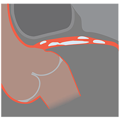 CT image