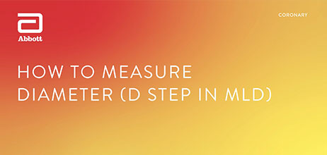 How to measure Diameter using MLD MAX