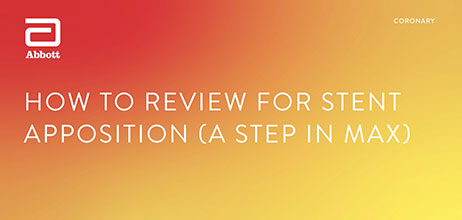 How to review for stent apposition using MLD MAX