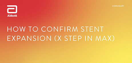 How to confirm stent expansion using MLD MAX