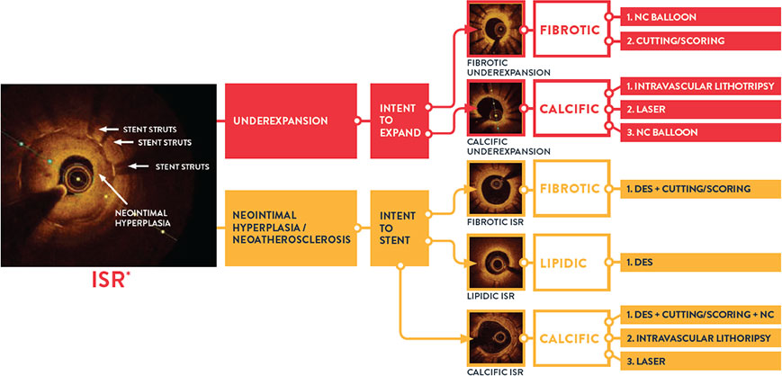  ISR algorithm