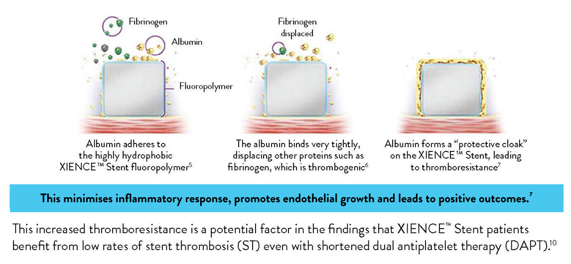 Three step graph showing how the albumin, which the XIENCE Stent’s fluoropolymer retains, minimizes inflammatory response, promotes endothelial growth and leads to positive outcomes. 