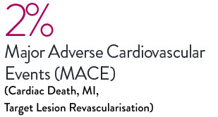 STEMI Registry shows XIENCE Stent with low 1.8% target vessel failure (primary endpoint).