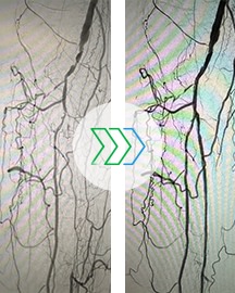 Dr. Corl Esprit BTK case study