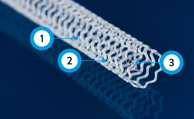 Esprit Scaffold Diagram
