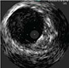  SUPERA™ STENT21