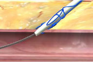  Lack of hemostasis