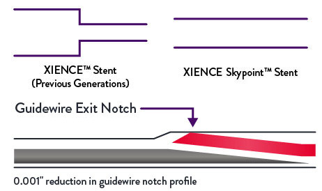 Skypoint Stent