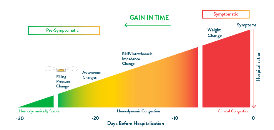 cardiomems wedge chart