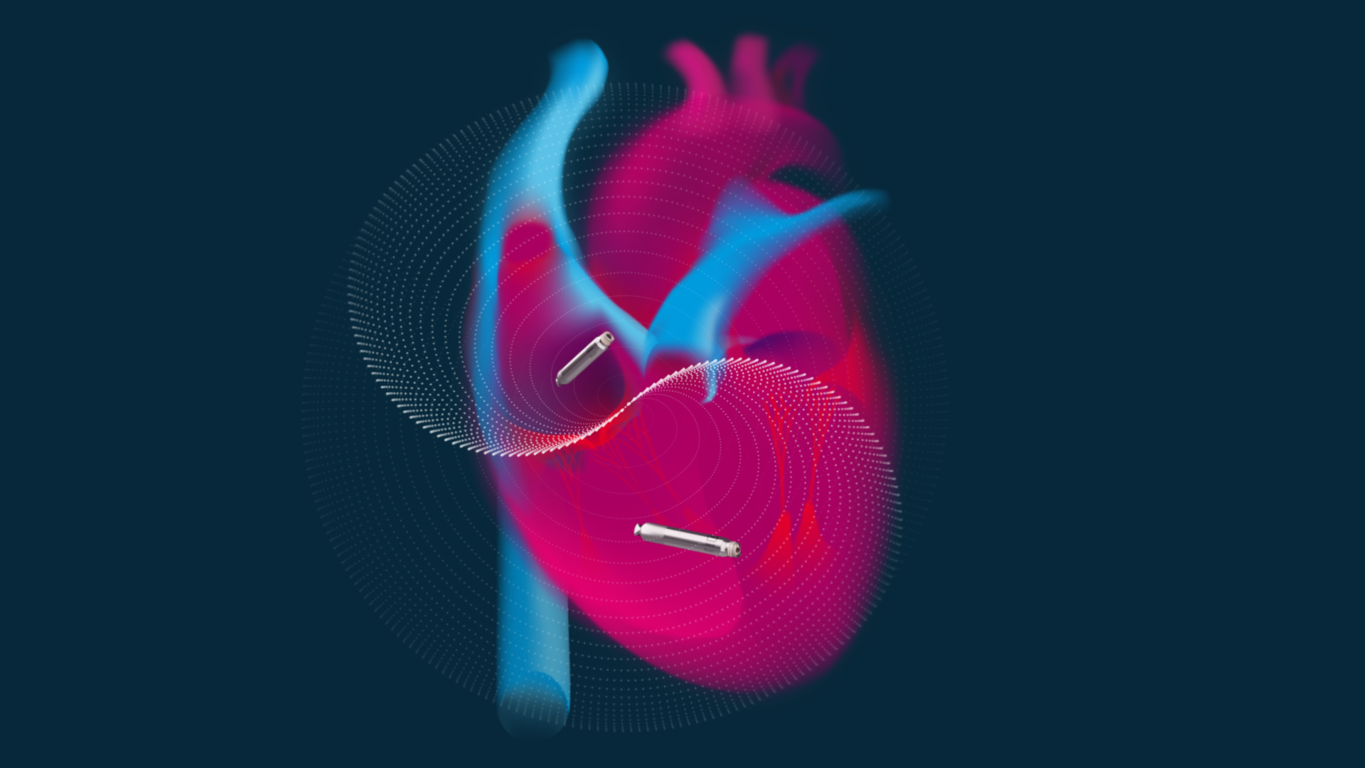   Image of a heart highlighting the placement of the leadless pacemakers
