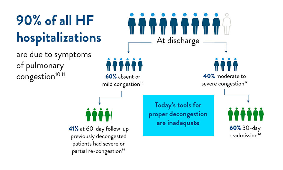90% of all HF hospitalizations are due to symptoms of pulmonary congestion
