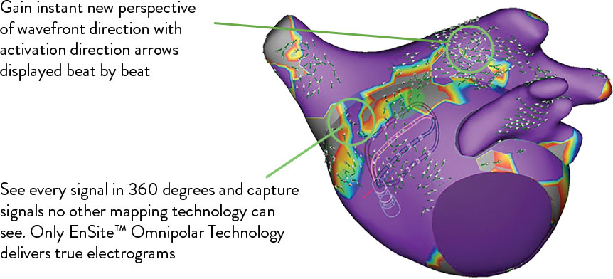  Illustration of a human heart