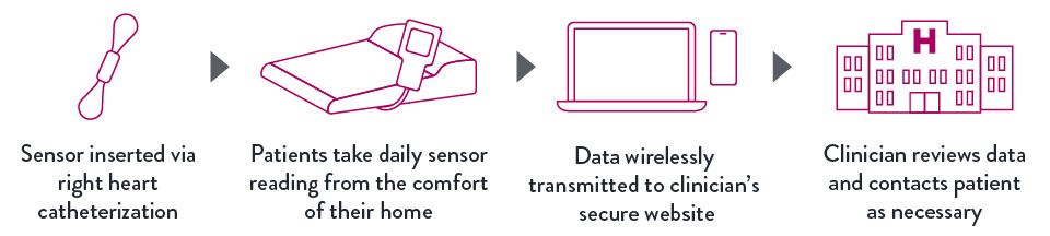 Icons showing PA pressure monitoring steps. First, the sensor is inserted via right heart catherization. Second, patients take daily sensor readings from the comfort of their home. Third, data wirelessly transmitted to clinician’s secure website. And finally, clinician reviews data and contacts patient as necessary.