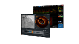 OCT Intravascular Imaging