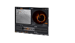 OCT Intravascular Imaging