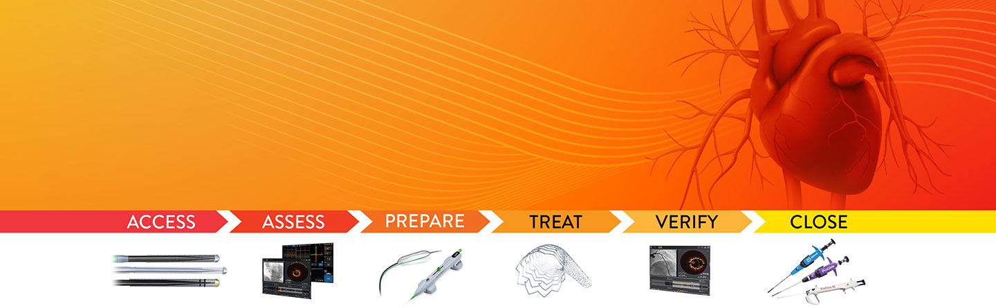 Individualized solutions for calcified lesions