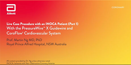 Live Case Procedure with an INOCA Patient (Part 1)